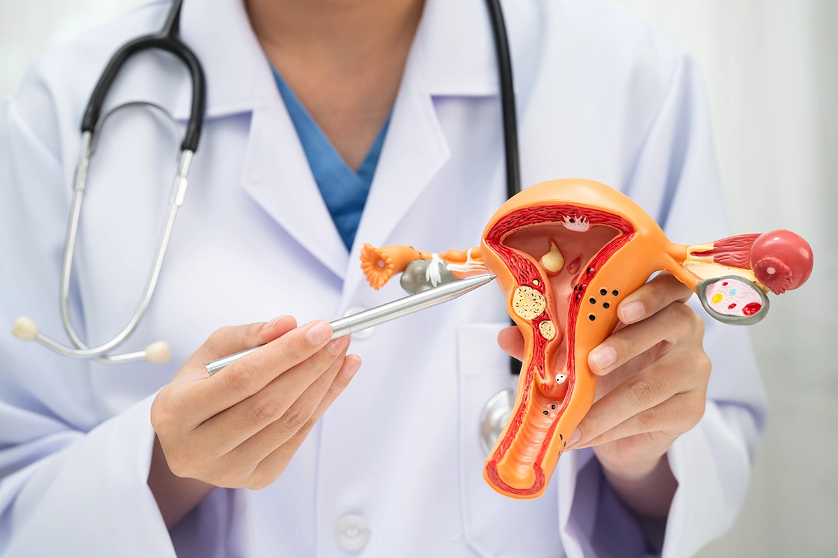 Ovarian cyst surgeon in consultation with a patient discussing ovarian cyst concerns. 